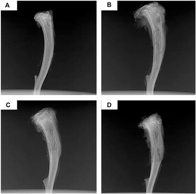 Current research progress of local drug delivery systems based on biodegradable polymers in treating chronic osteomyelitis